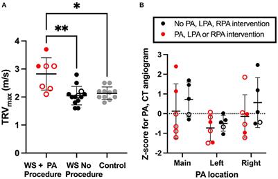 Elastin Insufficiency Confers Proximal and Distal Pulmonary Vasculopathy in Mice, Partially Remedied by the KATP Channel Opener Minoxidil: Considerations and Cautions for the Treatment of People With Williams-Beuren Syndrome